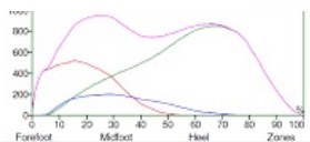Gait Chart
