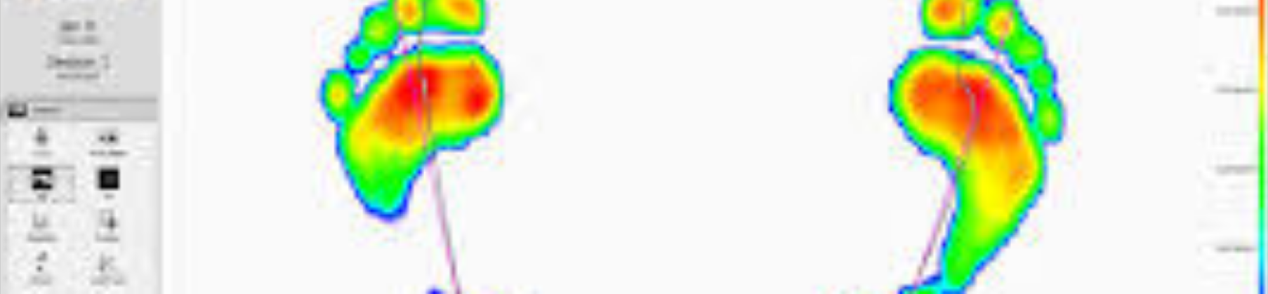 Gait analysis footer image